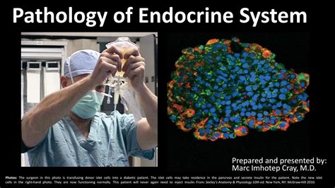 Endocrine System Pathology Ppt Lecture Series 5 In 1 By Marc Imhotep
