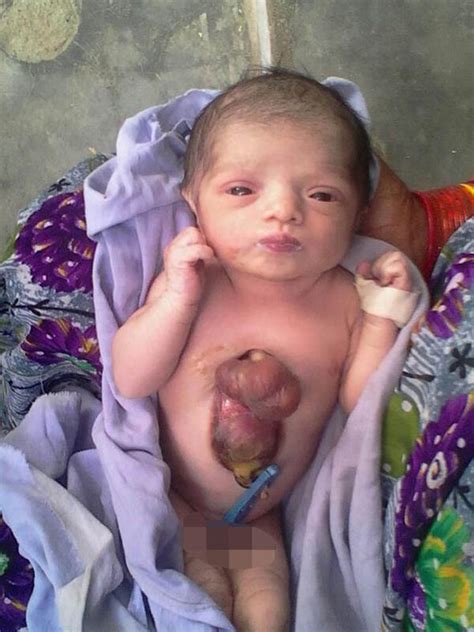 Read 283 reviews from the world's largest community for readers. WATCH: Baby with heart born OUTSIDE her body is prepped ...