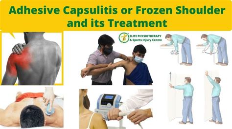 Adhesive Capsulitis Or Frozen Shoulder And Its Treatment