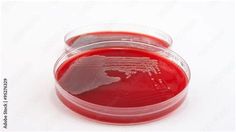 Escherichia Coli Bacteria On Columbia Blood Agar Stock Photo Adobe Stock