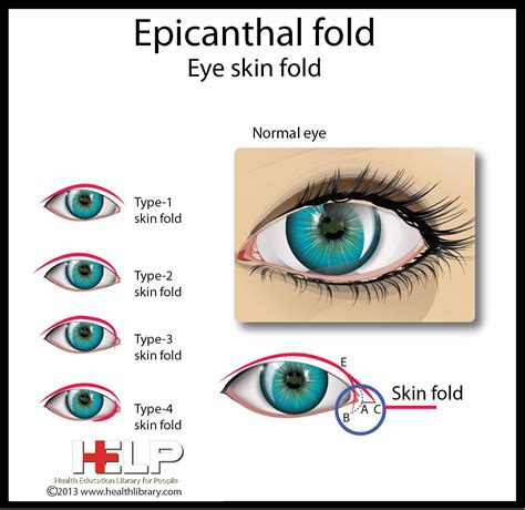 Epicanthal Folds Vs Normal Eye