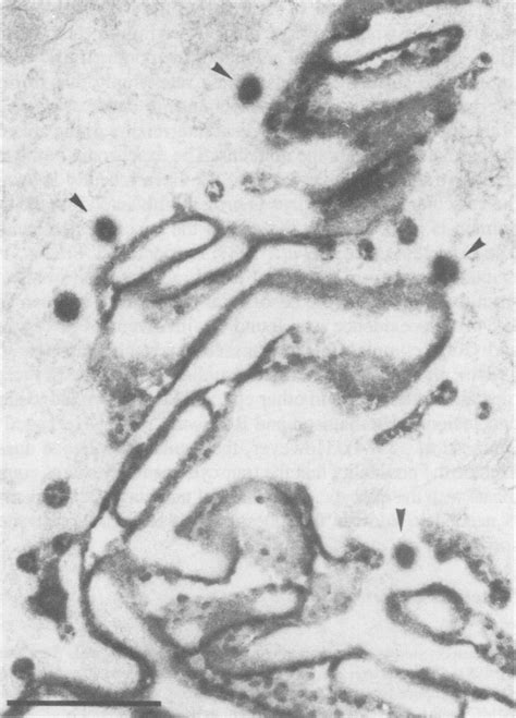 Electron Micrograph Of The Lateral Membranes Of Two Adjacent Cells