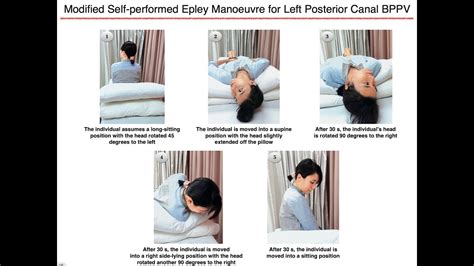 Modified Self Performed Epley Manoeuvre For Left Posterior Canal Bppv Youtube