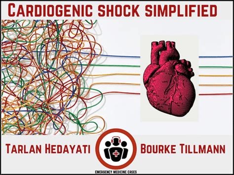 Cardiogenic Shock Simplified Emergency Medicine Cases