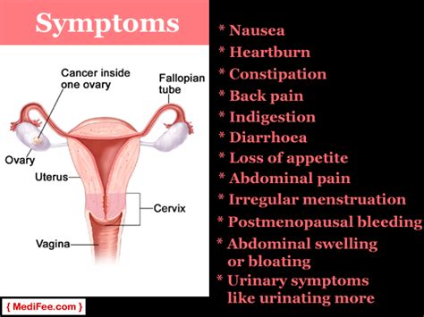 Swelling can feel like an irregular thickening on your testicle. Things You Must Know About Ovarian Cancer and Tests for it