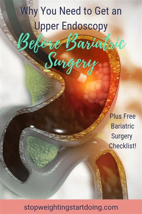 Why You Need To Get An Upper Endoscopy Before Bariatric Surgery Bariatric Surgery Bariatric