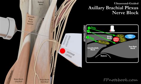 Axillary Nerve Block