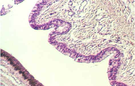 Pathology Outlines Anatomy And Histology Conjunctiva