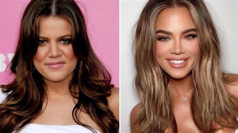 reason behind khloe kardashian transformation does khloe had plastic surgery