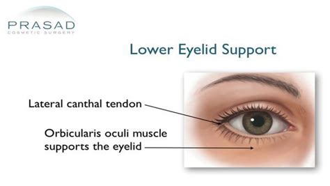 Eye Bag Surgery Lower Eyelid Surgery Puffy Eyes Ny