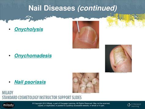 Ppt Chapter 10 Nail Disorders And Diseases Powerpoint Presentation