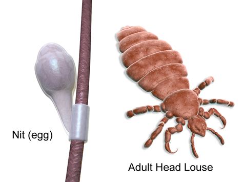 Human Head Lice What You Need To Know Massey Services Inc