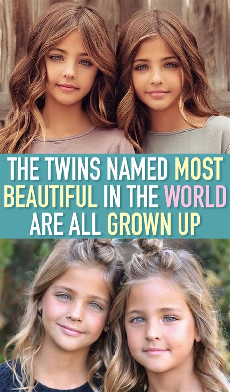 The Twins Named Most Beautiful In The World Are All Grown Up Twin