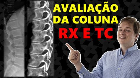 COMO AVALIAR TC E RX DA COLUNA ANATOMIA E ROTEIRO ESTRUTURADO YouTube