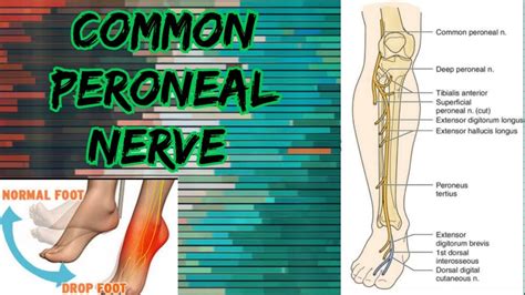 Common Peroneal Nerve Origin Coursebranches And Applied Anatomy