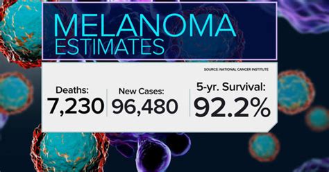 Melanoma Monday Survival Rates Improving Due To Treatment Advances