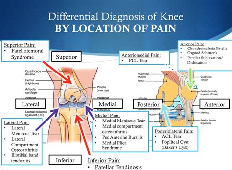 Anterior Knee Pain Scale