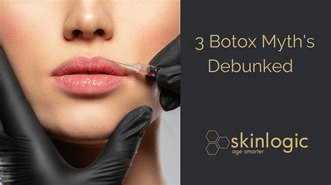 Top 3 Botox Myths Debunked