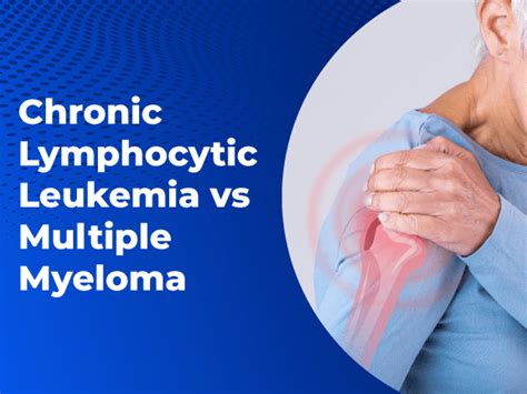 Chronic Lymphocytic Leukemia Vs Multiple Myeloma Massive Bio