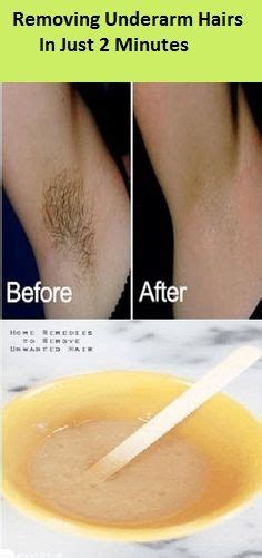 How To Remove Underarm Hair In Just 2 Minutes Simple Natural Solution Underarm Hair Health