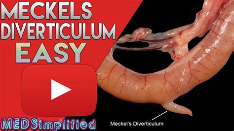 real incest familybad nude mom parenting fail$