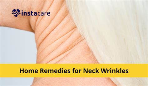 12 Proven Home Remedies For Neck Wrinkles