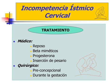 Ppt Incompetencia Stmico Cervical Cerclaje Powerpoint Presentation
