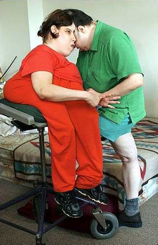 Dedicated to our healing community. Conjoined twins happy together | News, Sports, Jobs ...