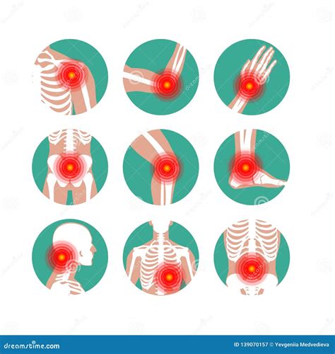 Rheumatism or Rheumatic Disorder Medical Set. Arthritis Joint Pain