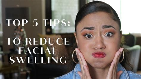 Top 5 Tips To Reduce Facial Swelling Youtube