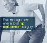 Pain Management After Knee Replacement Surgery Photos