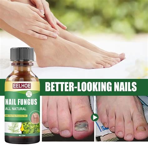 Nail Fungal Treatment Feet Care Essence Nail Foot Whitening Toe Nail