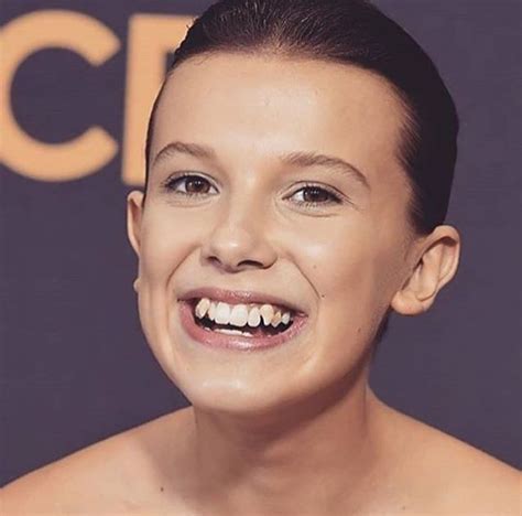 Millie Bobby Browns Plastic Surgery Before And After Teeth Surgery