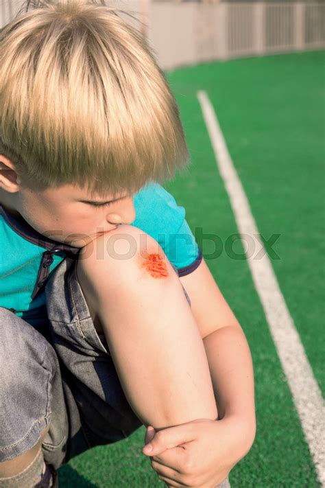 Boy With A Scraped Knee Stock Image Colourbox