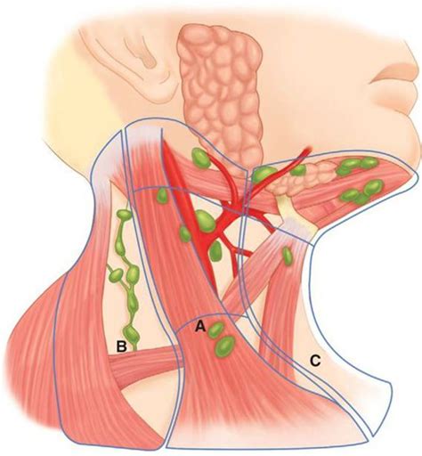 Neck Masses Cardinal Presentations Strange And Schafermeyers Pediatric Emergency Medicine