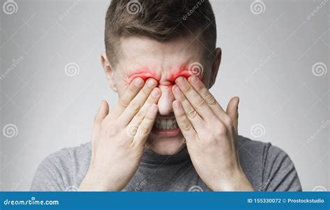 Tired Man Suffering From Eye Pain Rubbing Red Sore Zone Stock Photo