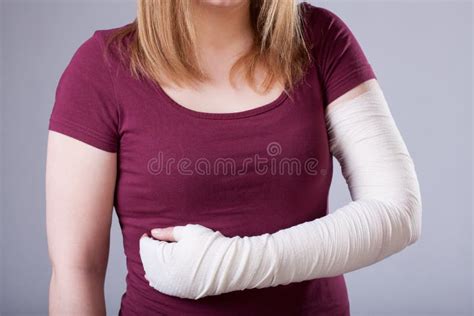 Woman With Bandaged Arm Stock Image Image Of Woman Twisted