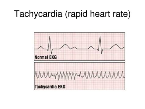 We'll give you five different methods and an easy way to determine your target heart rate. PPT - Cardiovascular System PowerPoint Presentation - ID ...