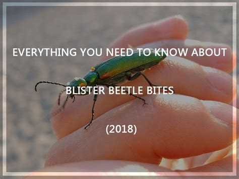 Everything You Need To Know About Blister Beetle Bites 2018 Pest Wiki