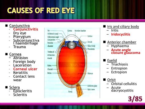 You mean the one with the red paint? Red eye