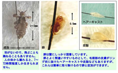 最高 50+ ヘアー キャスト 対策 - イメージ有名