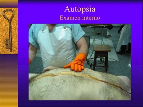 Diagnosticopatologia Autopsia De Fetos Kulturaupice