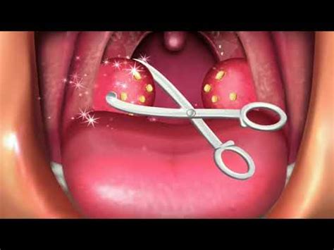 ASMR Surgery Asmr Surgery Asmr Animation Asmr Animation