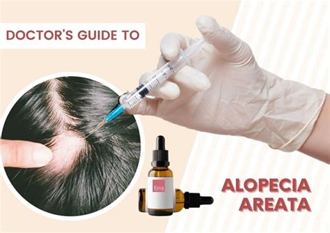 Discover 117 Alopecia Nails Treatment Vn