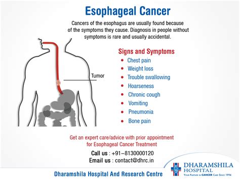 Esophagus Cancer Symptoms Causes Treatment Dr Nikhil Agrawal The Best