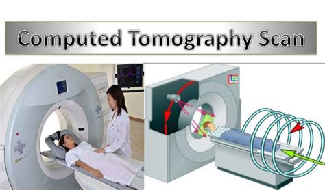 Ct Scan Computed Tomography What All Should You Know Omega Pds