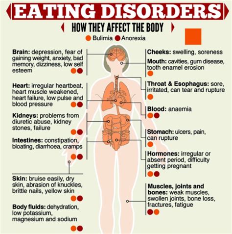 psychiatry eating disorders lecture 11 flashcards quizlet