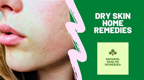 Natural Dry Skin Home Remedies Youtube