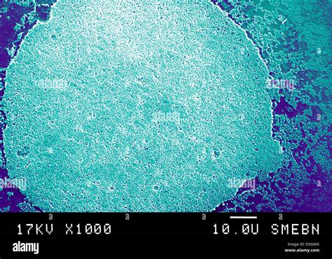Mycoplasma Hominis Microscopio Fotografías E Imágenes De Alta Resolución Alamy