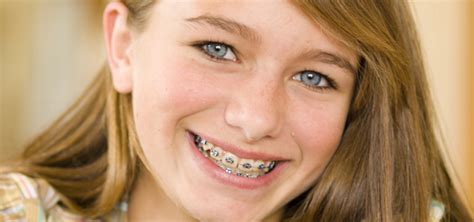 Tip Edge Orthodontics Aerni Dental Strongsville Dentist
